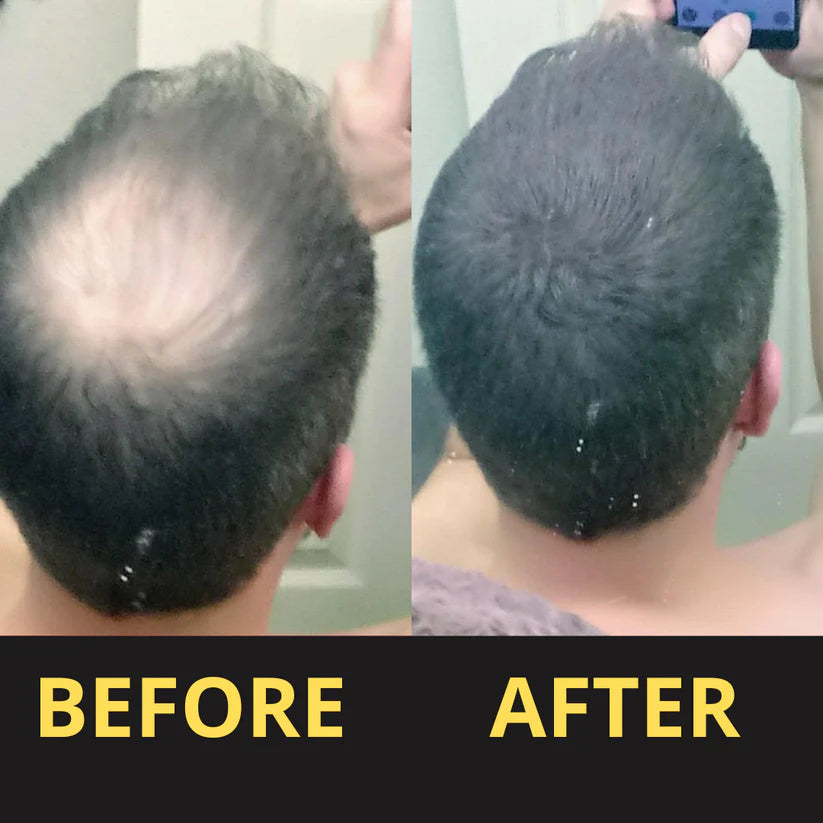 HAIRFILLUP HAIR CONCEALER BLACK 50ML - WATERPROOF 3-7 DAYS