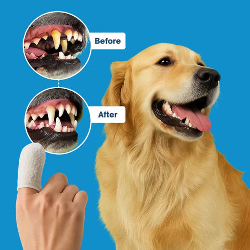 FreshWipes Kit - Protects Against Dental Diseases